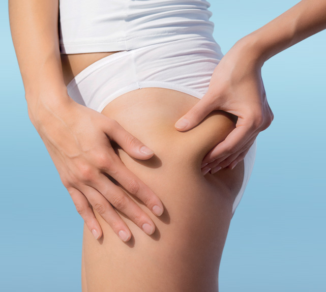 cellulite pancia